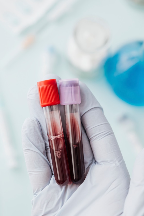 Afinal, o que é o Hemograma Completo?